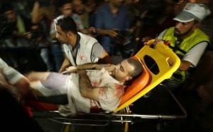 Wounded Palestinan