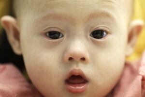 Thailand surrogate Down syndrome