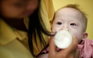Thailand surrogate Down syndrome