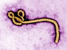 HEALTH-EBOLA/USA
