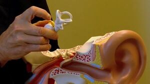 Vestibular sytstem