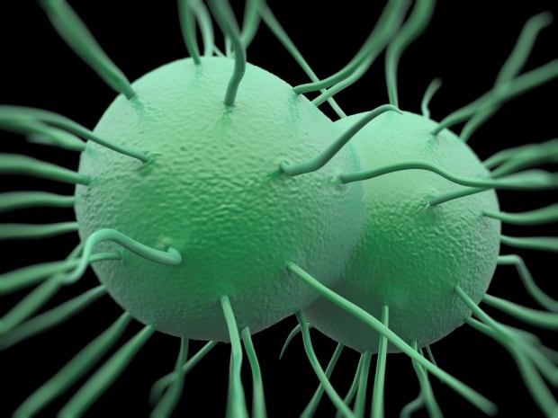 Gonorrhea