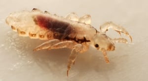 head lice