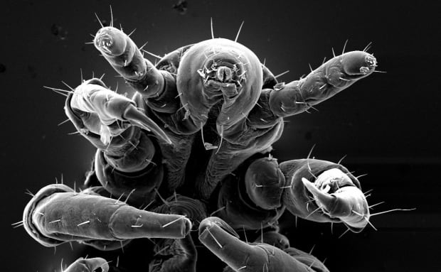 head louse