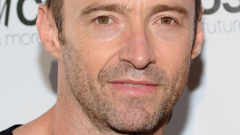 Hugh Jackman Has 3rd Skin Cancer Growth Removed CBC News
