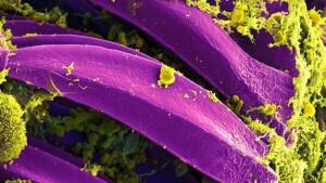 Plague bacteria