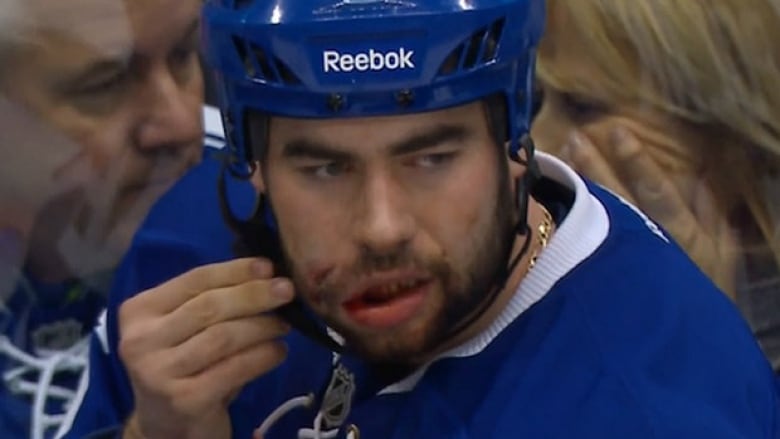 puck in the face nhl