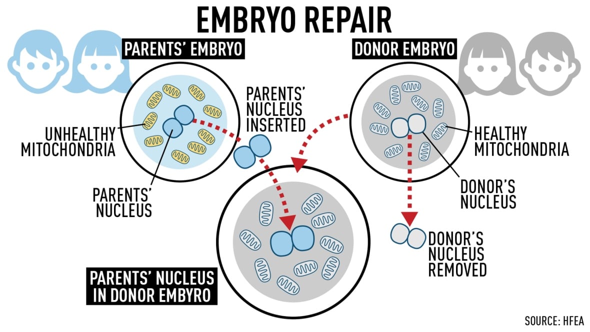 This graphic shows how the DNA, or nucleus, of the mother's egg can be put into the egg of the female donor, who has healthy mitochondria. This creates an egg with the mother's DNA that is free of mitochondrial disease