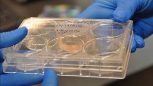 Beating heart cells in Petrie dish