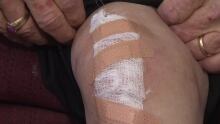 Charlie Whitman's knee took a grinding in the storm crawl.