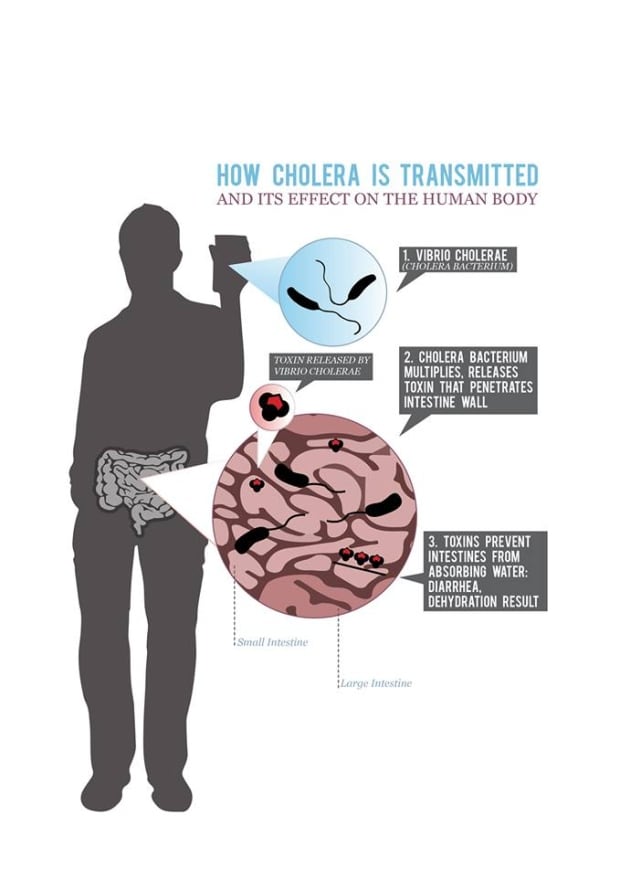 Cholera graphic