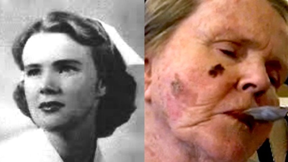 Left: Margot Bentley as a young nurse. Right: Margot Bentley today.