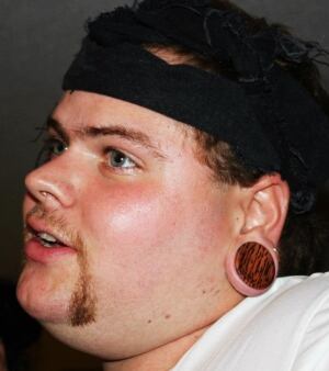 Kurt Barnett ear stretching surgery