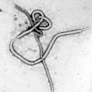 Tekmira Ebola Drug 20150619