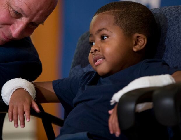 Double Hand Transplant-Child