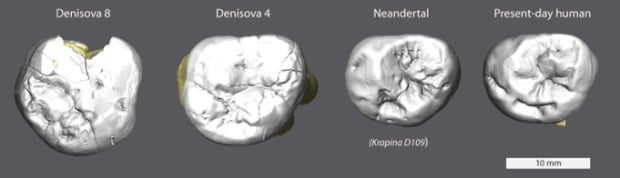 Denisova teeth
