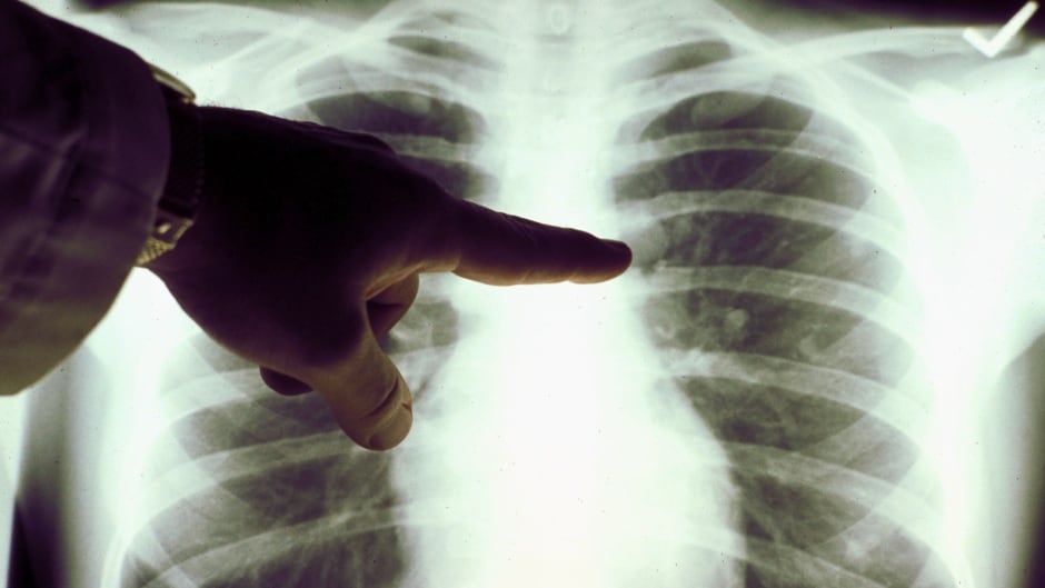 Luck versus lifestyle: Which is more important when it comes to cancer?