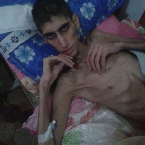 Starving Boy