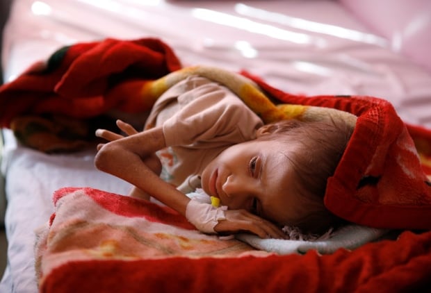 APTOPIX Mideast War And Hunger