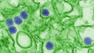Zika virus