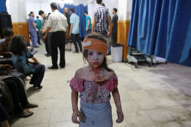 AFP PICTURES OF THE YEAR 2015-SYRIA-CONFLICT