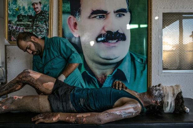 World Press Photo 2016 1st prize general news singles injured IS fighter by Mauricio Lima