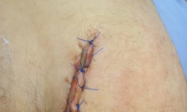 Ross Pointer injury (cropped)