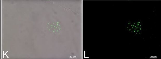 Keratan sulfate