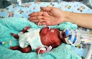 CHINA premature infant