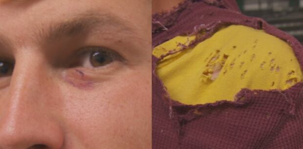Coombs World Parrot Refuge Matt Spate Eye Injury Ripped Shoulder