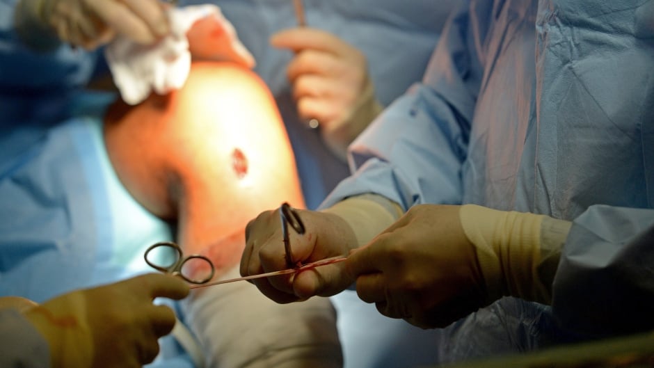 A surgeon prepares a section of the patellar tendon he removed from the leg of his patient to use it as a graft to repair a torn anterior cruciate ligament.)