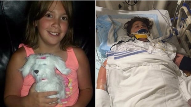 My Car North Bay >> 'Freak accident' has Airdrie girl in medically-induced coma, family devastated | CBC News My Car North Bay >> 'Freak accident' has Airdrie girl in medically-induced coma, family devastated | CBC News
