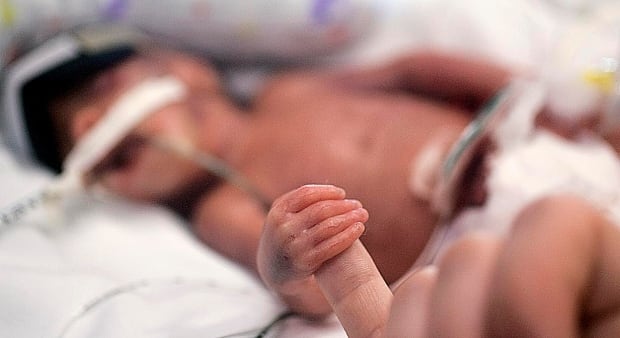 Juniper in NICU
