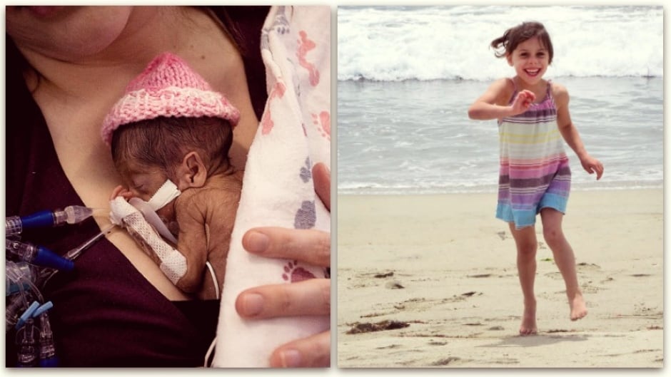 Inside the neonatal intensive care unit, Juniper's parents faced tough decisions.
'Our daughter's diaper was the size of a pack of Trident," Kelley French says of her micro-preemie baby, Juniper. The story of her birth and survival highlights
the disruptive force of our medical technology and forces the question of when life begins.