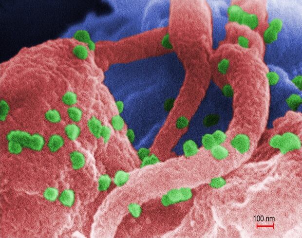HIV Research 20150807
