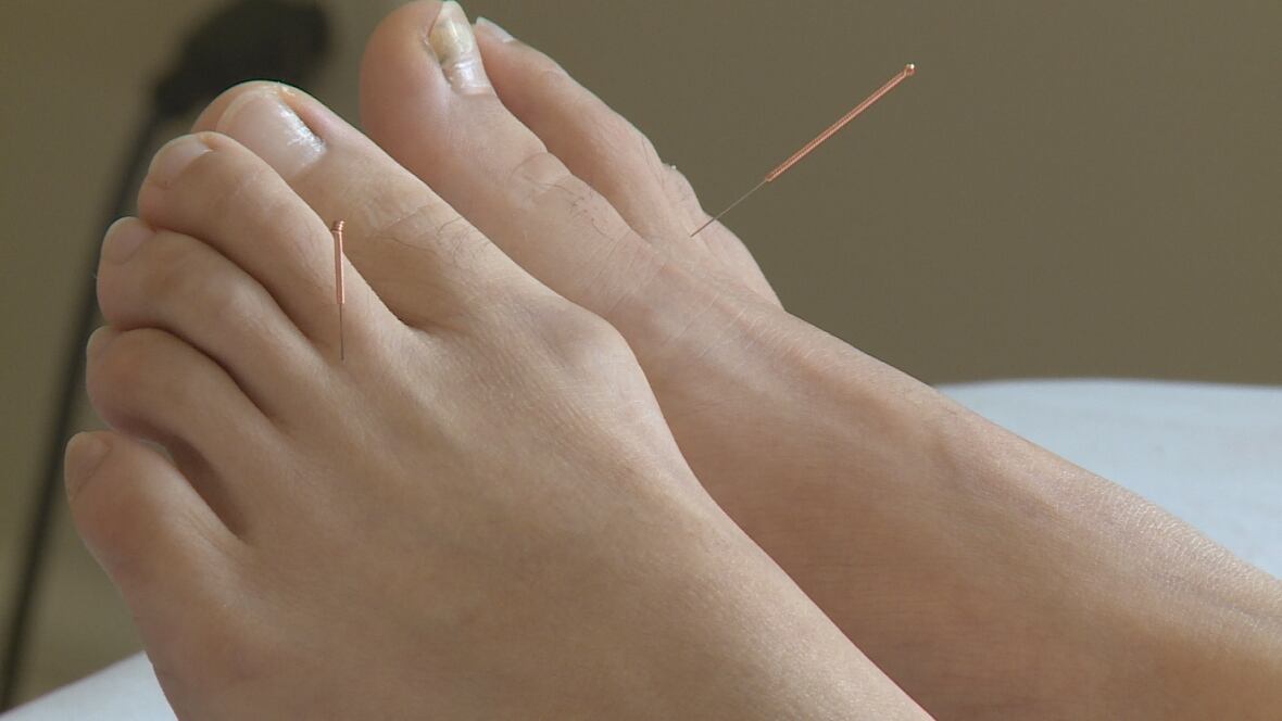 P.E.I. doctor giving free clinics offering Chinese medicine CBC News