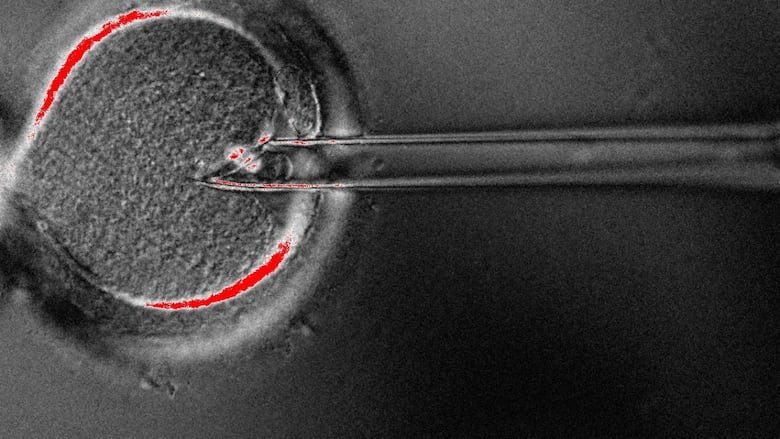 Enucleation pipette inserted inside egg to remove spindle (nucleus).