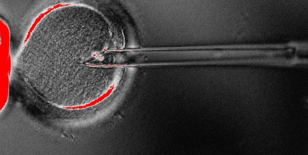 Enucleation pipette inserted inside egg to remove spindle (nucleus).