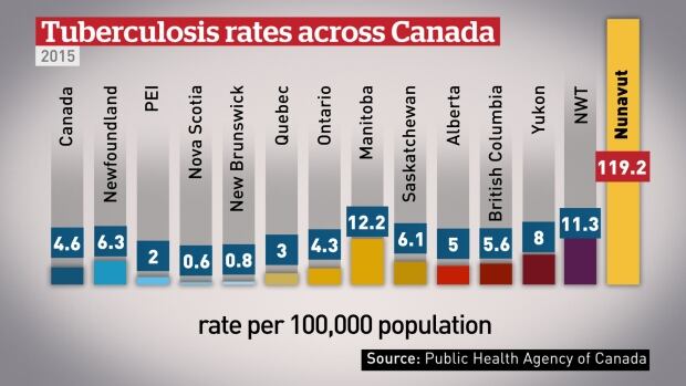 Tuberculosis rates