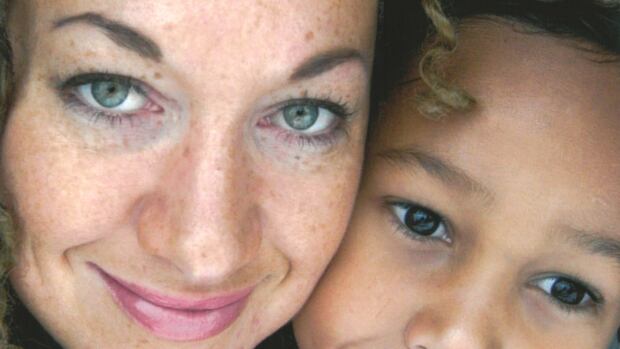 Rachel Dolezal | CBC Radio