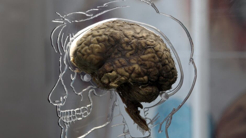 Brain scans can reveal the degree of intent behind criminal behaviours.