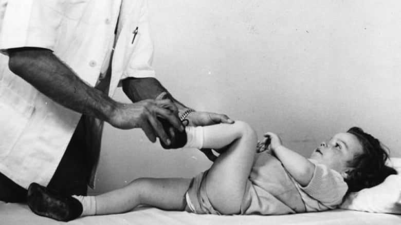 Polio Short leg 1, A polio short leg lady adjusts her hkafo…