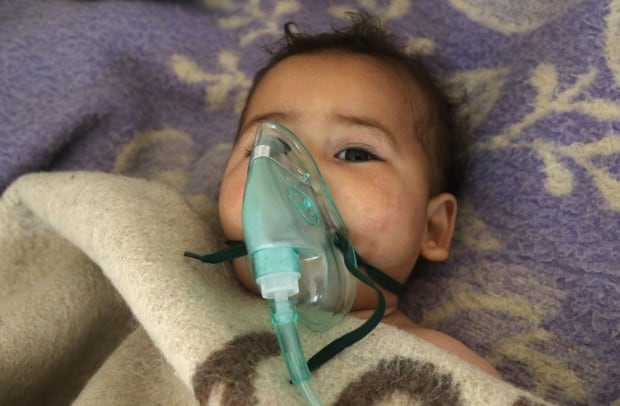 Syria child receives treatment suspected toxic gas attack