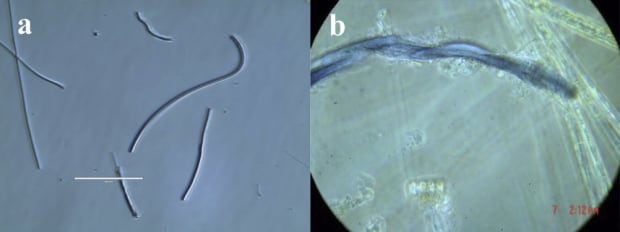 Images of microplastic