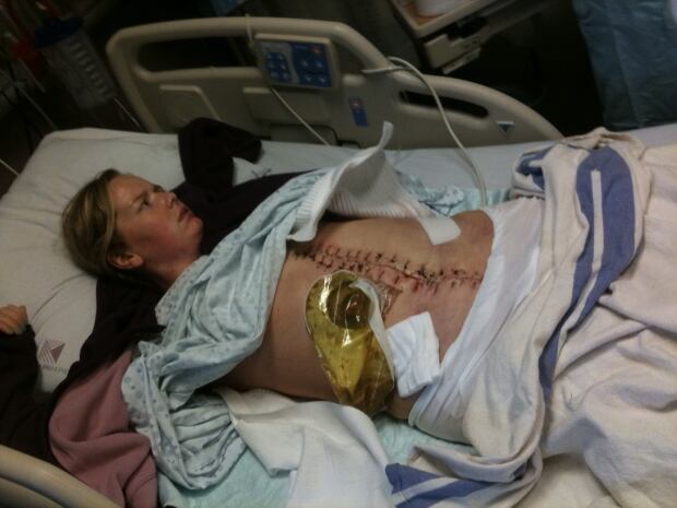 Mikaela Wilhelmson in hospital