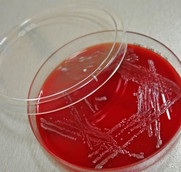 Enterococcus