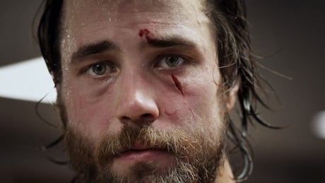 Swedish defenceman Victor Hedman suffered a laceration under his left eye on Friday at the world hockey championship. hedman-victor
