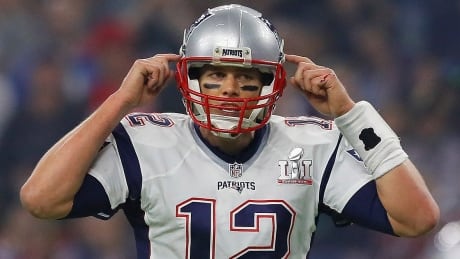 Gisele Bundchen says her husband, Patriots quarterback Tom Brady, suffered a concussion in 2016, the season in which he led the NFL club to another Super Bowl title. brady-tom-170205-1180