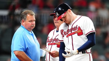 Braves first baseman Freddie Freeman was forced to leave Wednesday night's game against the Blue Jays after being hit on the hand by a pitch from reliever Aaron Loup. On Thursday, tests showed a fractured left wrist and he'll be sidelined about 10 weeks. freeman-freddie-051817