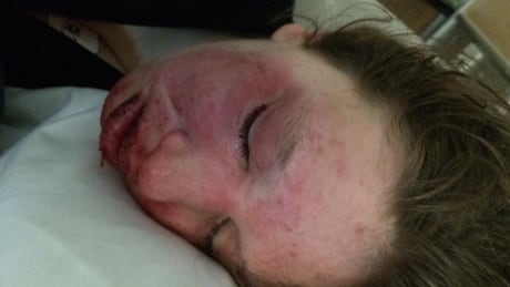 'It felt cruel': Family seeking solution for nonverbal, autistic, self-harming teen